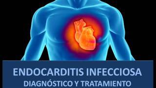 Endocarditis infecciosa  Diagnóstico y tratamiento [upl. by Fayina]