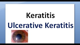 Ophthalmology 110 a Keratitis Cornea Inflammation Corneal Ulcer Ulcerative Ulceration [upl. by Aicirtal]