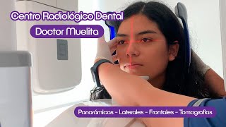 🦷 Ahora en Doctor Muelita contamos con nuestro propio CENTRO RADIOLÓGICO DENTAL [upl. by Elroy]