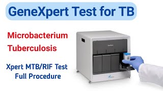 GeneXpert Test for TB  Full Procedure  Xpert MTBRIF Test  Creative Zone Plus [upl. by Andy344]