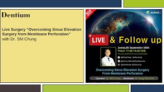 Live Surgery “Overcoming Sinus Elevation Surgery from Membrane Perforation” [upl. by Lundell395]