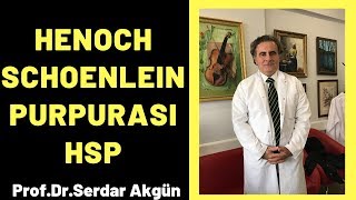 Henoch Schonlein Purpurası HSP Serdar Akgün [upl. by Hoj]