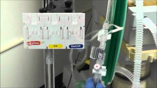 How to Setup an Arterial Line Transducer [upl. by Ermentrude]