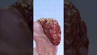 Liver Cirrhosis The Silent Killer You Need to Know About 3D visualization with VOKA Anatomy Pro [upl. by Hamrah908]