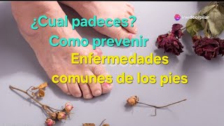 ¿Cuales son las dolencias más comunes de los pies [upl. by Patti]