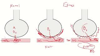 Diffuse Parenchymal Lung Disease ILD and Occupational Lung Disease Part 1 [upl. by Lundberg]