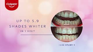 Colgate Optic White LightUp 10 InOffice Whitening Kit [upl. by Neitsabes]