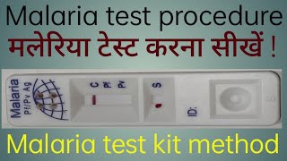 Malaria test kit method  Malaria test procedure  Malaria test kaise kiya jata hai [upl. by Airalav]