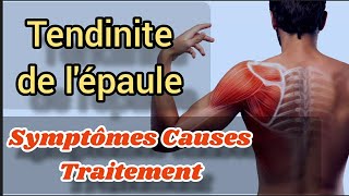 Tendinite de lépaule Causes symptômes traitement efficace Soulager Exercices coiffe des Rotateurs [upl. by Nomyad]