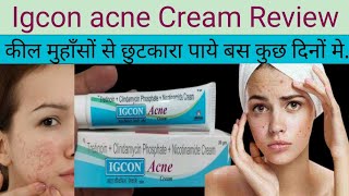 Igcon Acne Cream ke Fayde Igcon Acne Cream Uses in Hindi [upl. by Agate]