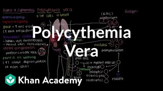 What is polycythemia vera  Hematologic System Diseases  NCLEXRN  Khan Academy [upl. by Tnemelc523]