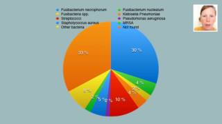 Lemierre’s syndrome – video abstract 95050 [upl. by Agatha]