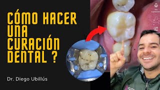 ✨Cómo hacer una curación dental En 3 minutos 🦷😃  Diego Ubillús [upl. by Uamak]