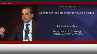 Quelles sont les sténoses aortiques à risque [upl. by Gans505]