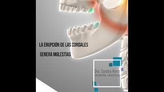 Extracción de Cordales  Dra Sandra Nieto Cirujana Oral y Maxilofacial [upl. by Vaenfila]