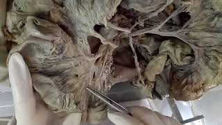 INTESTINES  BY DR MITESH DAVE [upl. by Gnav]