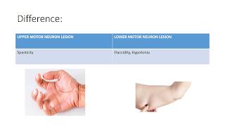 UMN vs LMN Lesion difference between Upper motor neuron and lower motor neuron lesions [upl. by Diba]