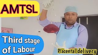 Third stage of labourPlacental deliveryAMTSL placenta delivery health nursing viralvideo gk [upl. by Darken]