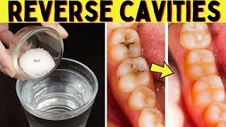 Effective Way To Get Rid Of Cavities And Heal Tooth Decay Naturally  Stop Tooth Decay [upl. by Roselia]