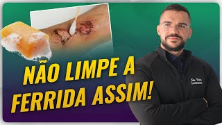 POSSO LIMPAR FERIDA COM ÁGUA E SABÃO [upl. by Lock]