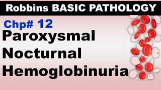 Ch12  Paroxysmal Nocturnal Hemoglobinuria  Blood Pathology  Dr Asif Lectures [upl. by Daughtry]