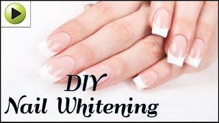 How to Whiten Your Nails Naturally [upl. by Baecher]