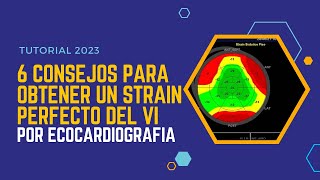 🚀Seis consejos para obtener un 💪STRAIN PERFECTO por ECOCARDIOGRAFÍA [upl. by Atilemrac]