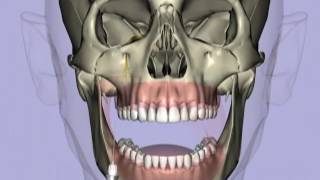 techniques maxillary injection techniquesmp4 [upl. by Airitac]