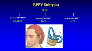 BPPV  Preliminary Insights [upl. by Clayton]