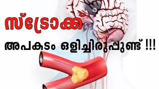 സ്ട്രോക്ക് വന്നാൽ ശരീരം കാണിക്കുന്ന ചില ലക്ഷണങ്ങൾ  DOCTOR INTERVIEW  STROCK [upl. by Odnalref]