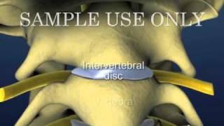 Cervical Spine and Intervertebral Disc Anatomy  Male Version [upl. by Scevour]