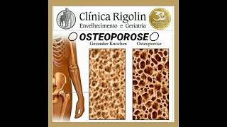 OSSOS POROSOS  OSTEOPOROSE [upl. by Milli701]