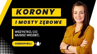 Korony i mosty zębowe Wszystko co musisz widzieć [upl. by Searby]