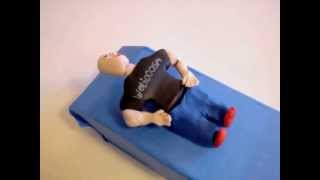 DixHallpike and Epley Maneuvers for BPPV in Claymation [upl. by Ahsienek]