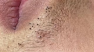 Satisfying Relaxation Skin Video With Dr Thuy Quynh Giao Spa 03 31052021 [upl. by Aihtela]