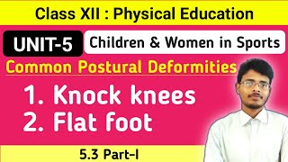 531 What is Knock knees and Flat footCommon Postural DeformitiesPhysical EducationClass 12 [upl. by Keriann]