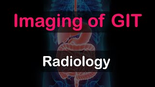 Radiology Imaging modalities of GIT [upl. by Kcirad]