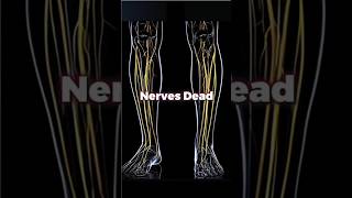 Nerves Dead Leg shorts [upl. by Jacintha]