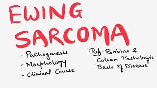 Ewing Sarcoma  Bone Tumors  Pathology of Ewing Sarcoma  General Pathology Bone Tumors [upl. by Penn]