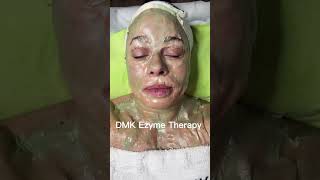 Microneedling w DMK facial by Nyle Lynn microneedling enzyme facial dmk selfcare spaday [upl. by Mccormick689]