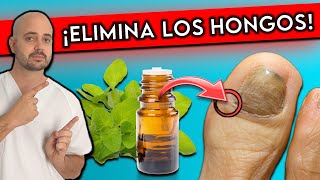 ¡Elimina HONGOS en las UÑAS en 1 DÍA  10 REMEDIOS NATURALES para HONGOS en las UÑAS [upl. by Vorster500]