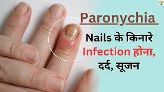 Nails के किनारे की Skin में Inflammation होना Homeopathy for nail infections Paronychia [upl. by Letsyrc]