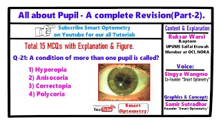 All about Pupil  A complete RevisionPart2 [upl. by Akinorev]