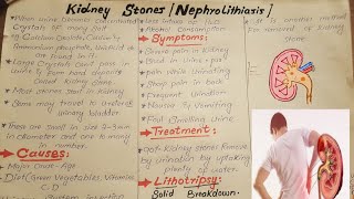 Kidney stonesNephrolithiasisCausesSymptoms and Treatmenteducationalvideoseducation [upl. by Namajneb]