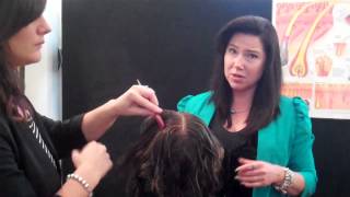 Hair Loss Natural Treatments with Microneedle Therapy [upl. by Eivol]