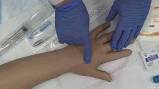 Intravenous IV Saline Lock Insertion [upl. by Kavanaugh]