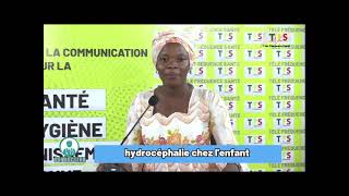 OUI Docteur  Hydrocéphalie chez lenfant avec le Pr Moussa Diallo part2 [upl. by Yelsha]