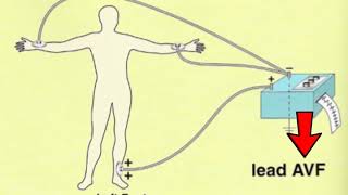 🔴 LES 12 DÉRIVATIONS ECG EXPLIQUÉES TRÈS CLAIREMENT  DR ASTUCE [upl. by Dylan]