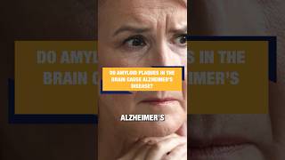 Do Amyloid Plaques in the Brain Cause Alzheimer’s Disease [upl. by Yila]