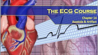 The ECG Course  Asystole amp Artifact [upl. by Adnomal]